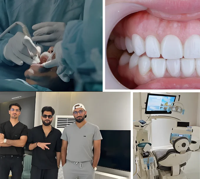 Why Patients Trust Teeth & Gums for Scaling and Polishing Why Patients Trust Teeth & Gums for Scaling and Polishing