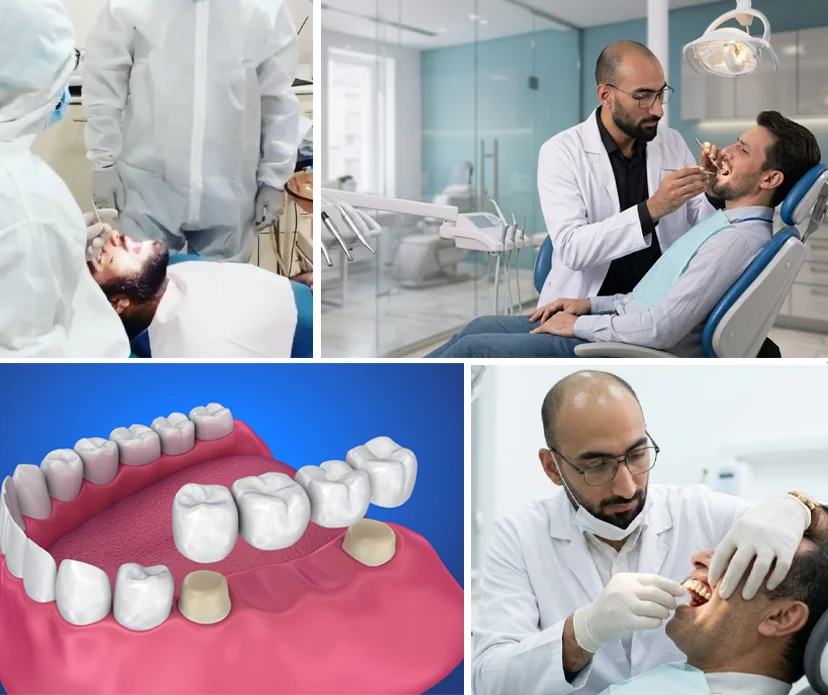 What Are Dental Bridges?