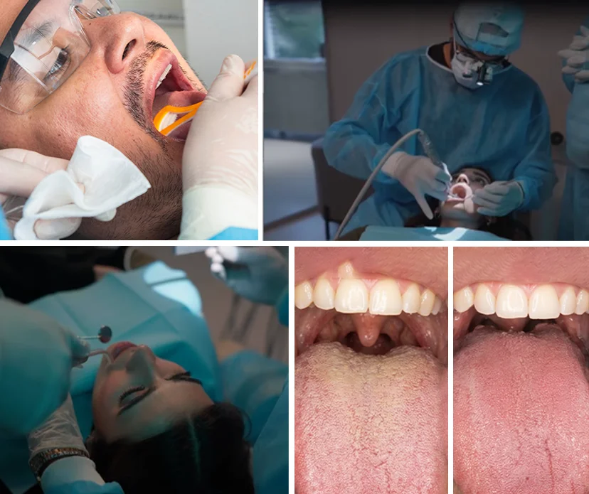 What Causes Bad Breath? What Causes Bad Breath?