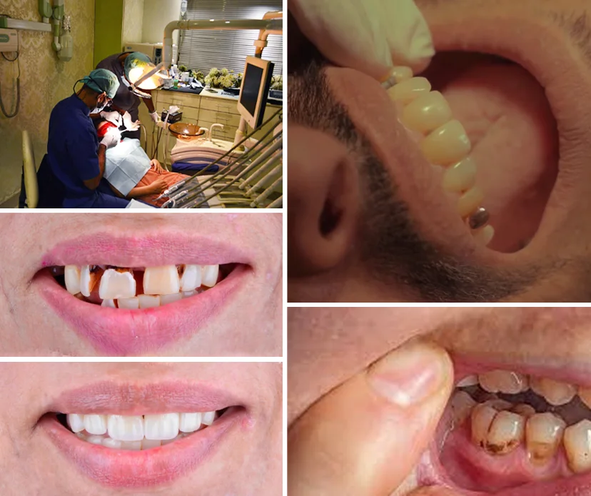 What Causes a Toothache? What Causes a Toothache?