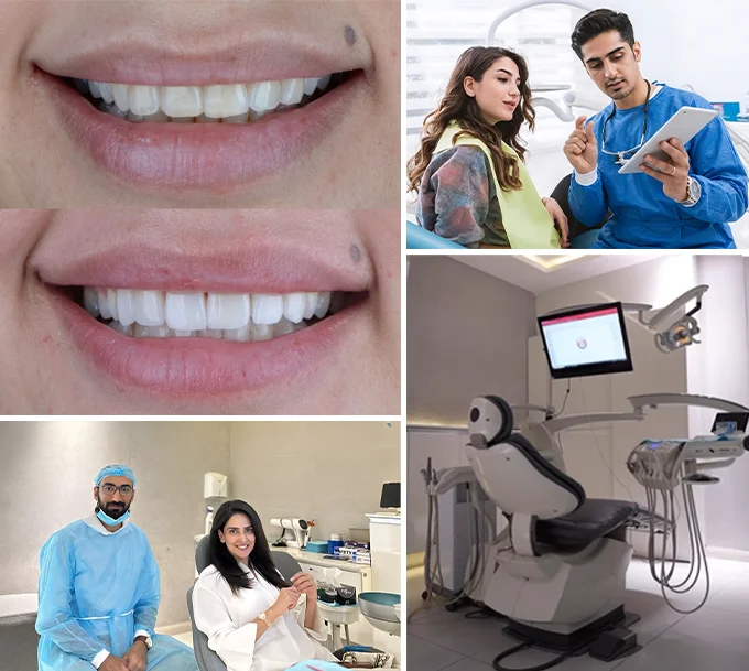 Why Patients Trust Teeth & Gums for Dry Mouth Treatment Why Patients Trust Teeth & Gums for Dry Mouth Treatment