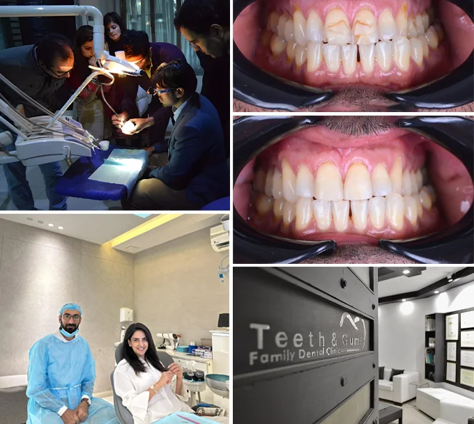 Why Patients Trust Teeth & Gums for Toothache Treatment Why Patients Trust Teeth & Gums for Toothache Treatment