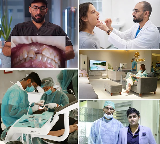 Why Choose Teeth and Gums for Tooth Abscess Treatment in Lahore Why Choose Teeth and Gums for Tooth Abscess Treatment in Lahore