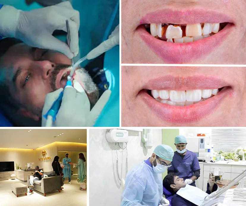 Why Patients Choose Teeth and Gums for Broken Tooth Treatment Why Patients Choose Teeth and Gums for Broken Tooth Treatment