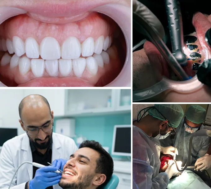 Why Patients Trust Teeth & Gums for Smile Makeover in Lahore