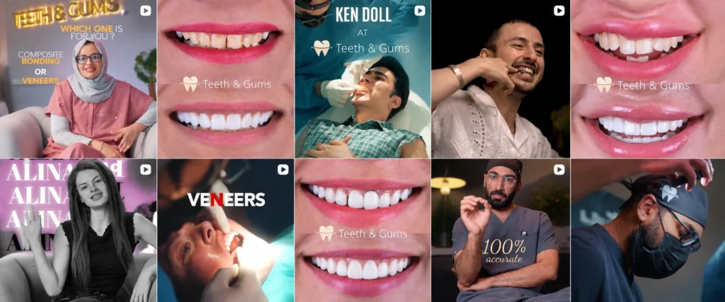 best smilemakeover expert - Dr. Saqib Zia Ahmed Toor