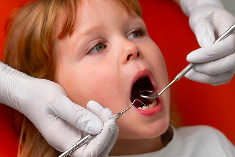 Dental-Caries-&-Tooth-Decay Dental-Caries-&-Tooth-Decay
