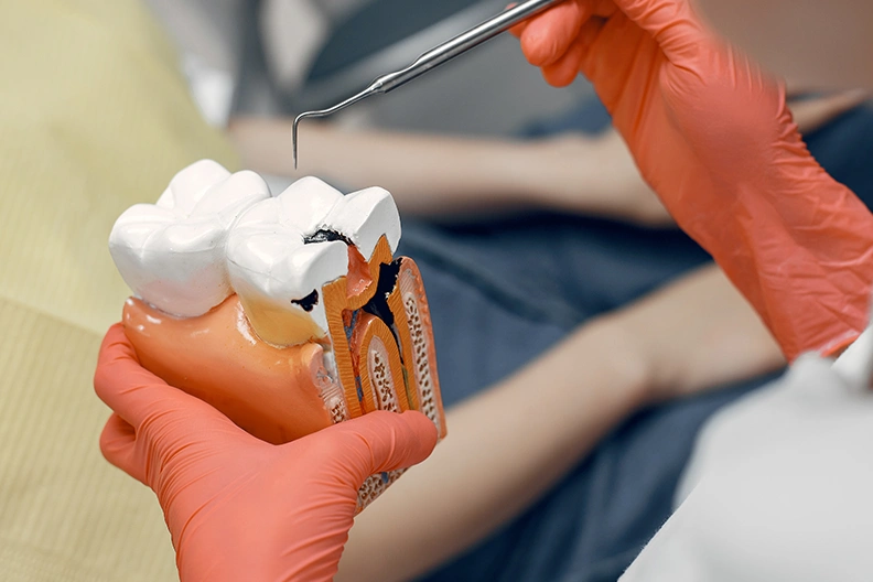 Our-Approach-to-Endodontic-Care