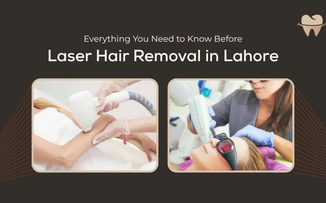 Everything You Need to Know Before Laser Hair Removal in Lahore