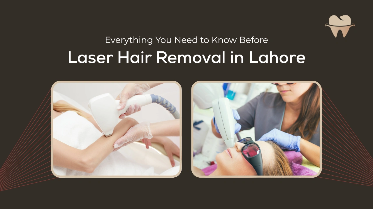 Laser Hair Removal in Lahore in 2025 - Everything You Need to Know
