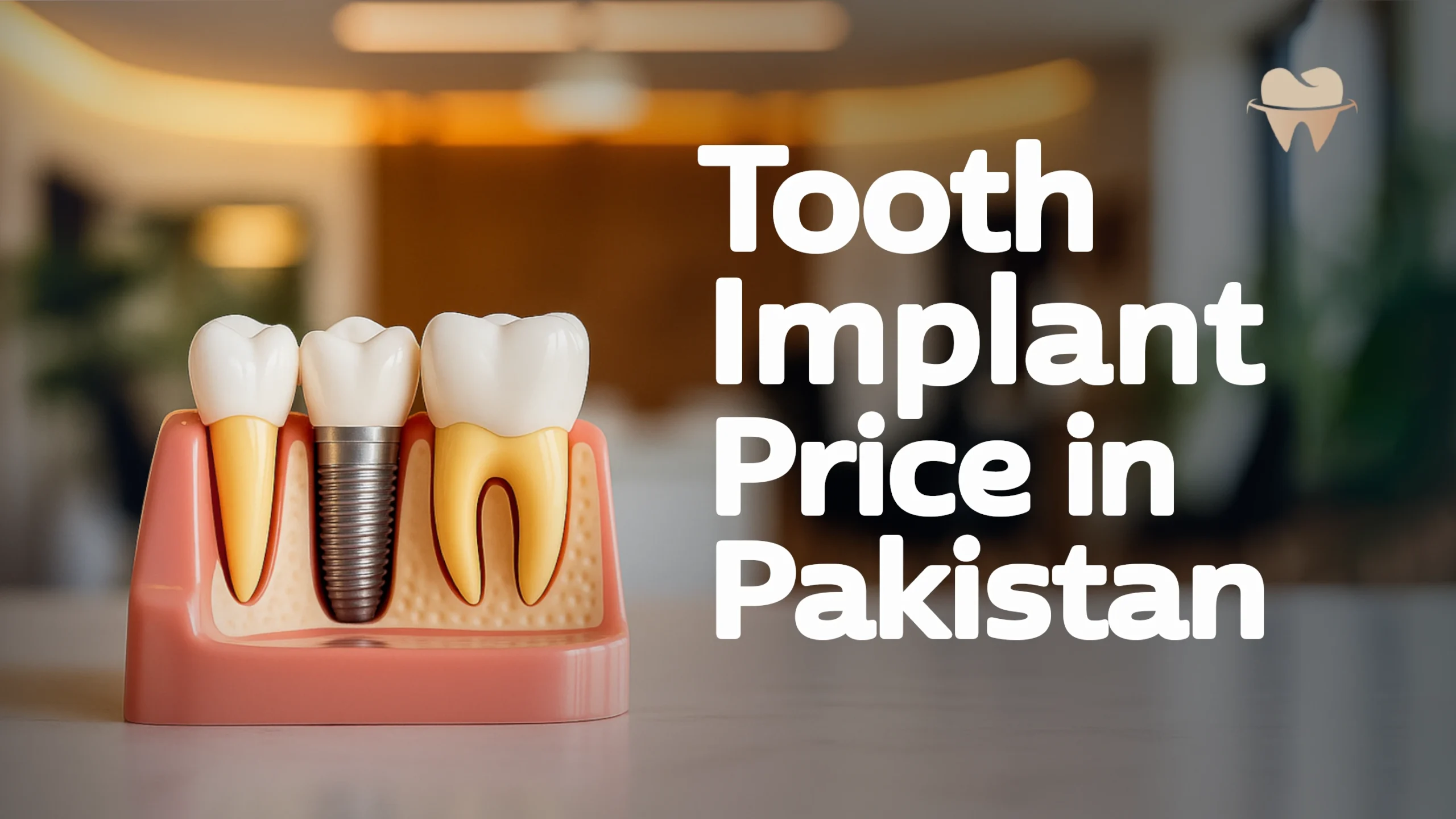 Tooth Implant Price in Pakistan in 2025 – An Overview Tooth Implant Price in Pakistan in 2025 - An Overview