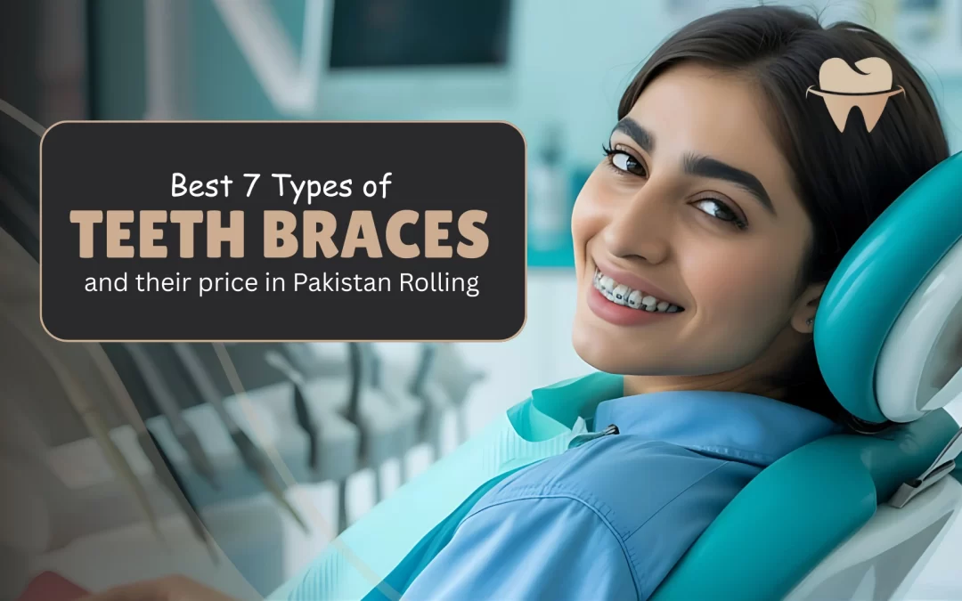 Best 7 Types of Braces in Pakistan and Their Prices
