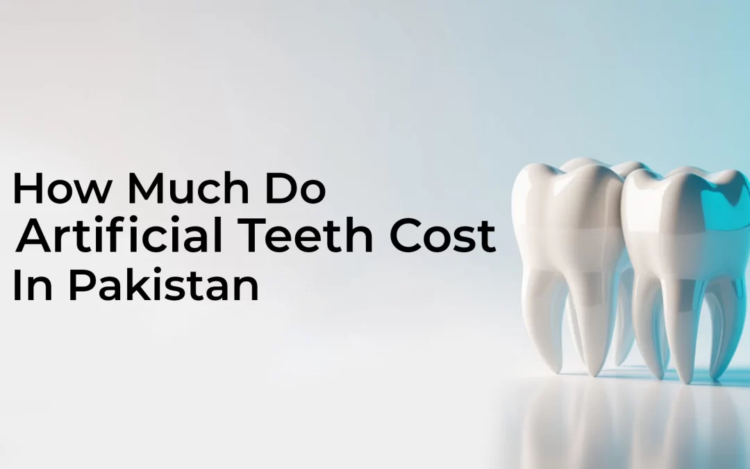 How Much Do Artificial Teeth Cost in Pakistan – A 2025 Guide