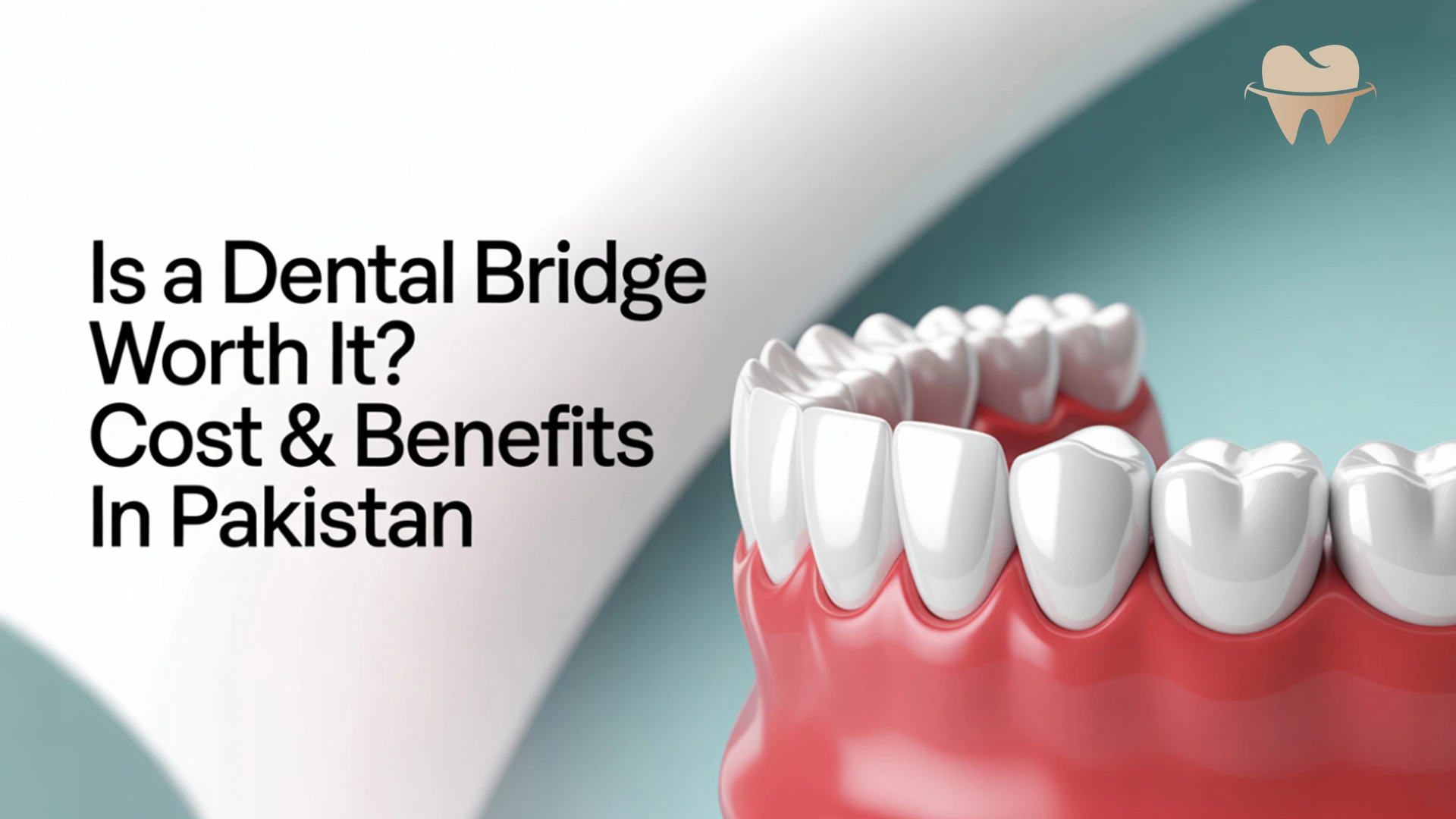 Dental Bridge Cost & Benefits in Pakistan in 2025 Dental Bridge Cost & Benefits in Pakistan in 2025