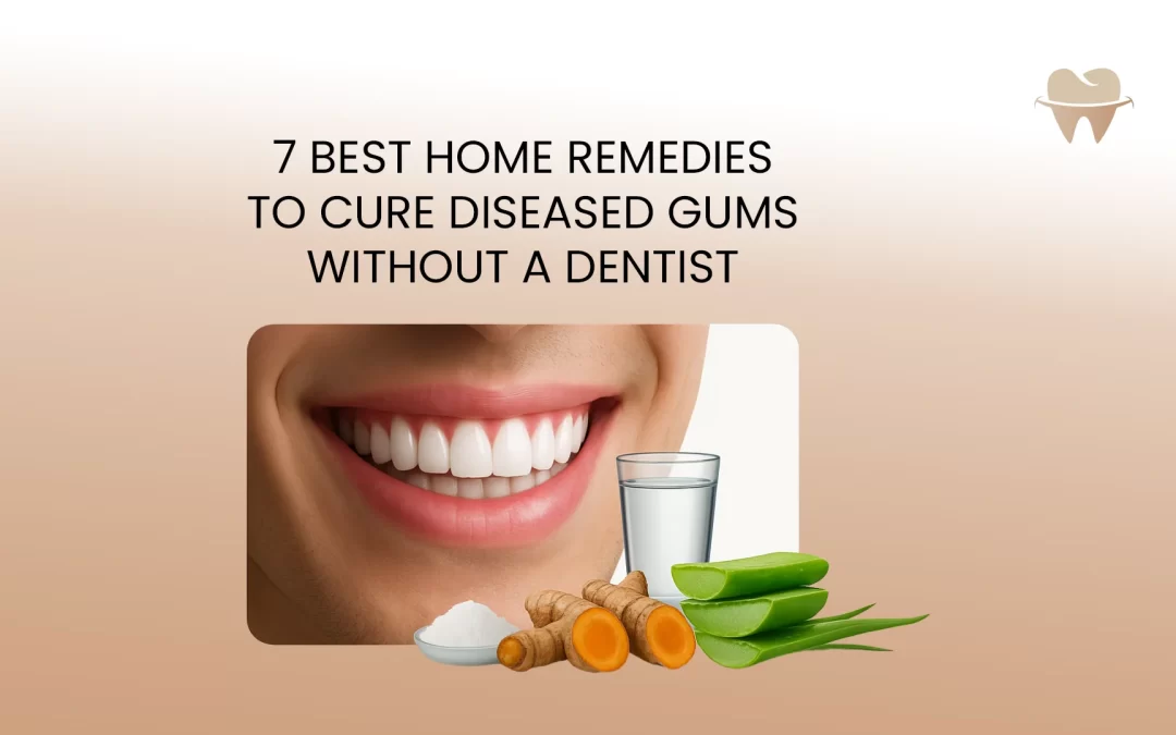 7 Best Home Remedies to Cure Diseased Gums Without a Dentist