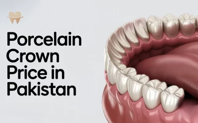 Porcelain Crown Price in Pakistan – Updated Cost Guide 2025