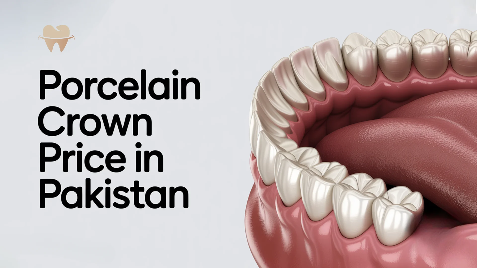 Porcelain Crown Price in Pakistan – Updated Cost Guide Porcelain Crown Price in Pakistan – Updated Cost Guide