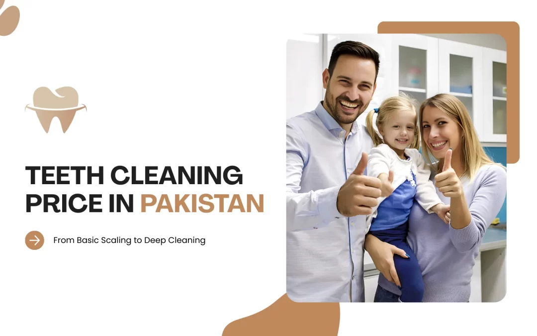Teeth Cleaning Price in Pakistan – From Basic Scaling to Deep Cleaning