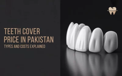 Teeth Cover Price in Pakistan: Types and Costs Explained