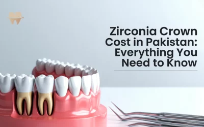 Zirconia Crown Cost in Pakistan: Everything You Need to Know