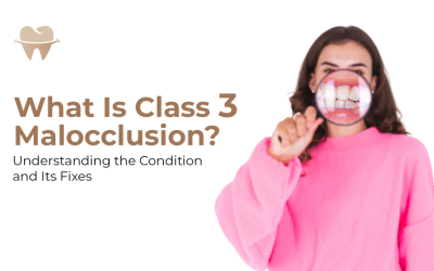 What Is Class 3 Malocclusion? Understanding the Condition and Its Fixes