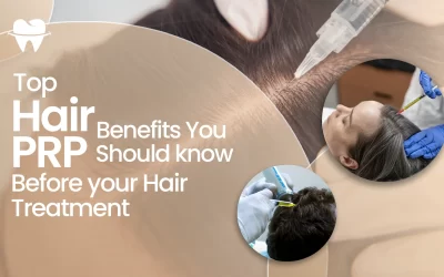 Top Hair PRP Benefits You Should Know Before Your Hair Treatment