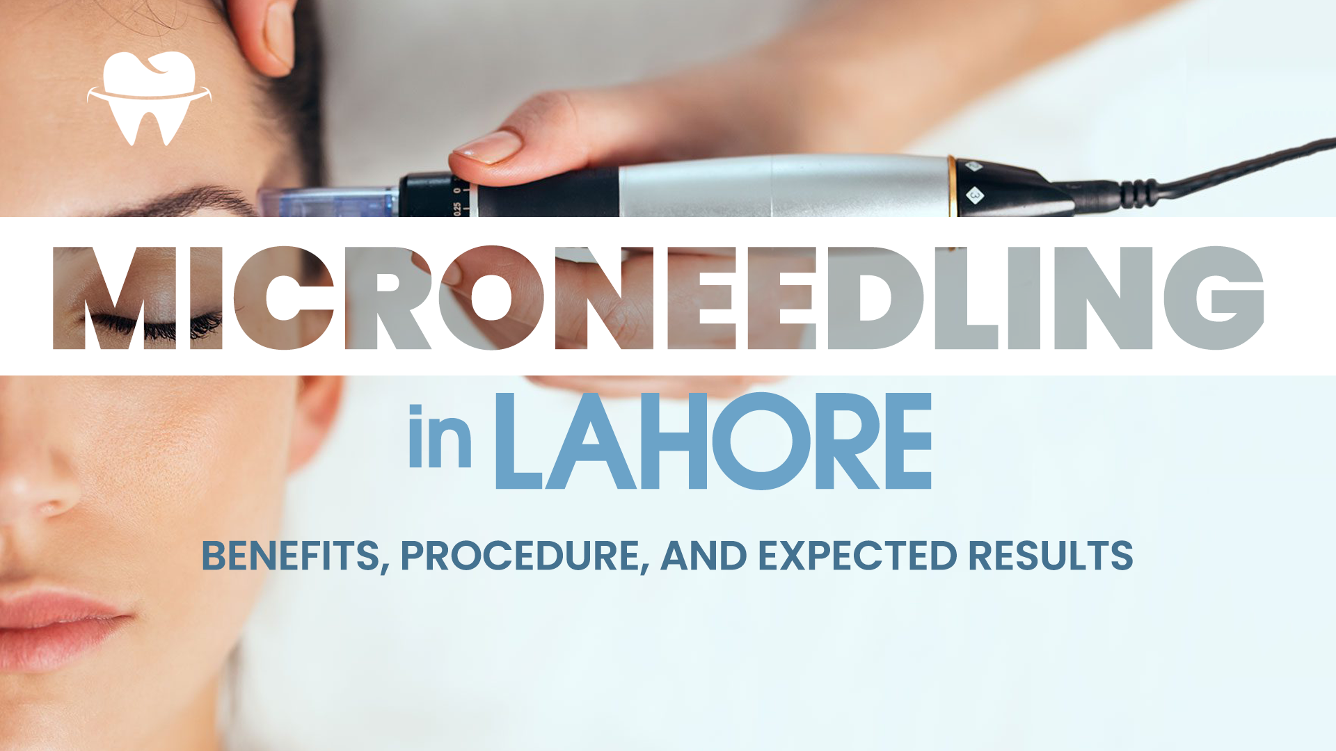 Microneedling in Lahore Microneedling in Lahore