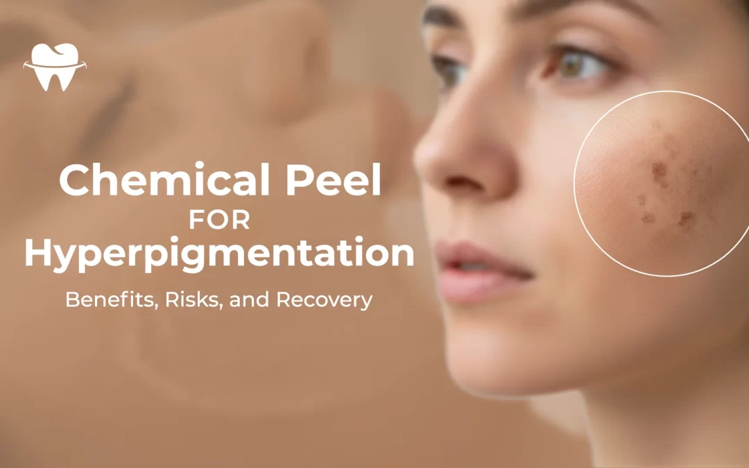 Chemical Peel for Hyperpigmentation: Benefits, Risks, and Recovery