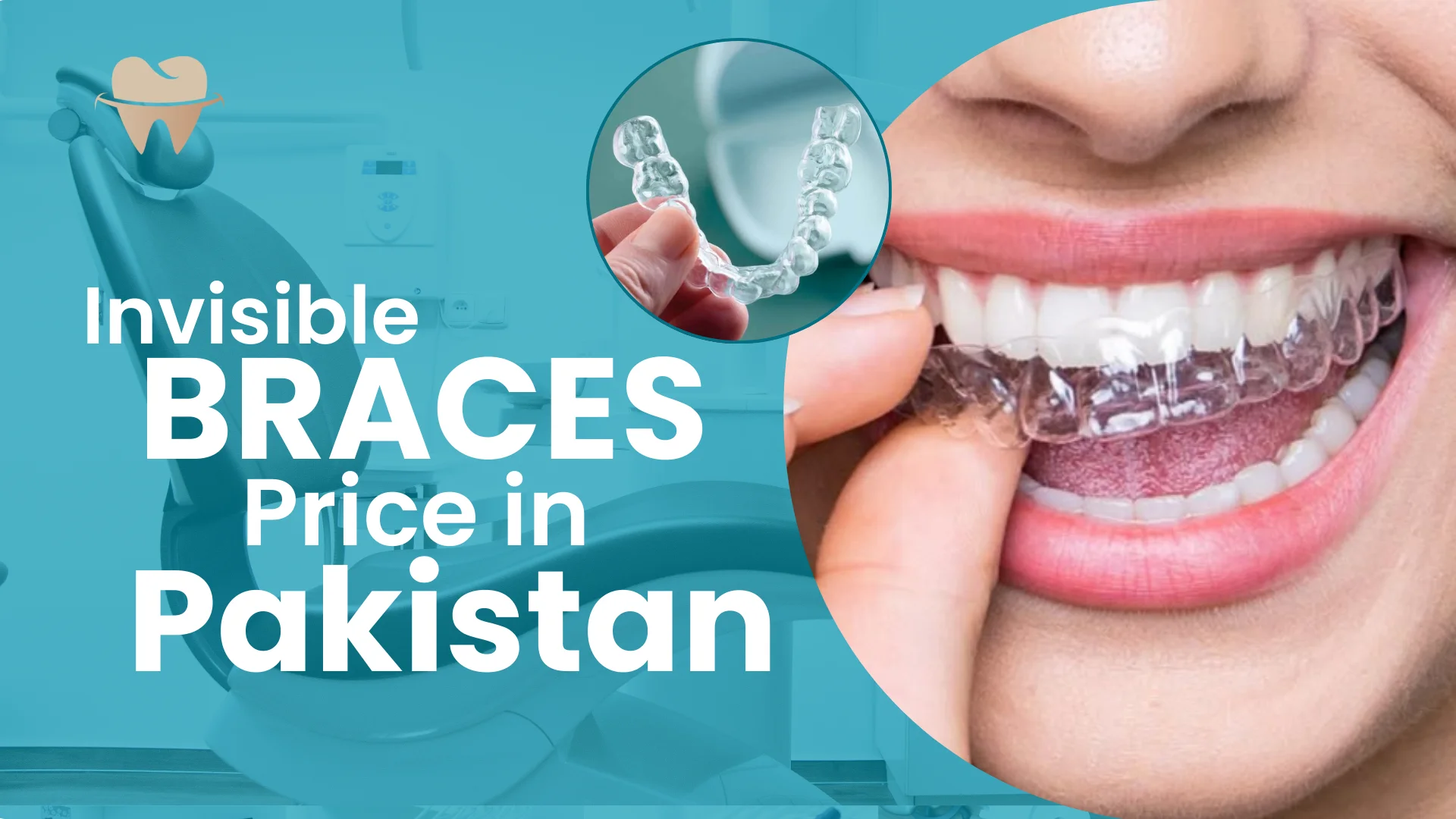 Invisible Braces Price in Pakistan Invisible Braces Price in Pakistan