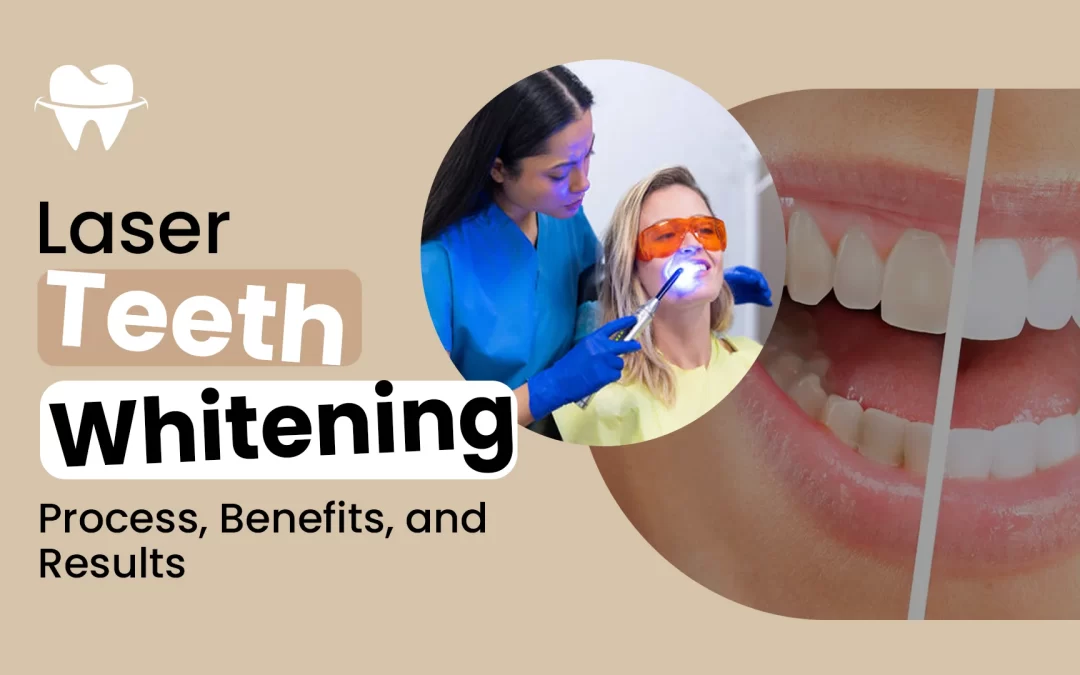 Laser Teeth Whitening: Process, Benefits, and Results