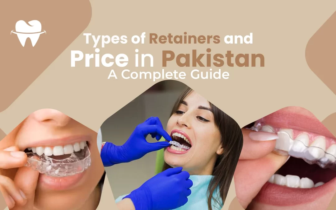 Types of Retainers and Price in Pakistan: A Complete Guide