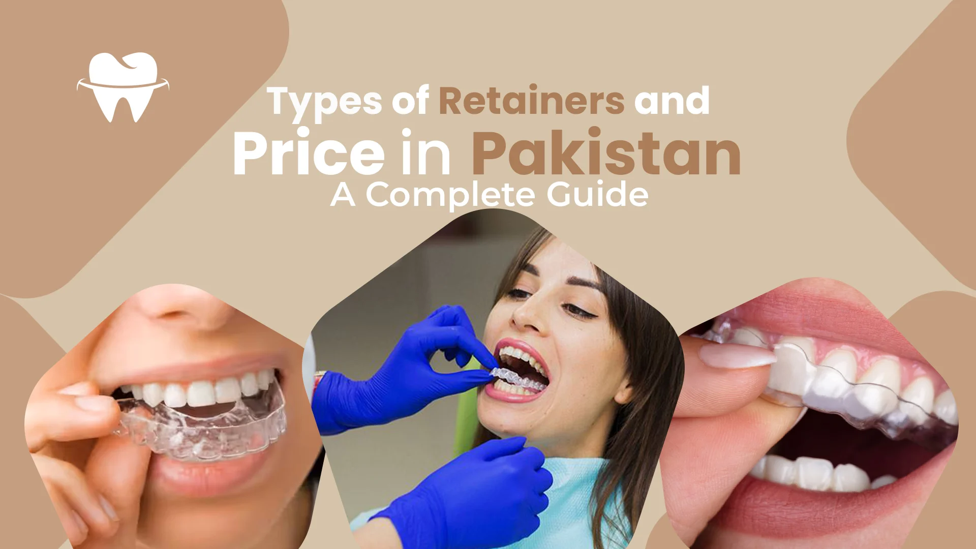 Types of Retainers and Price in Pakistan