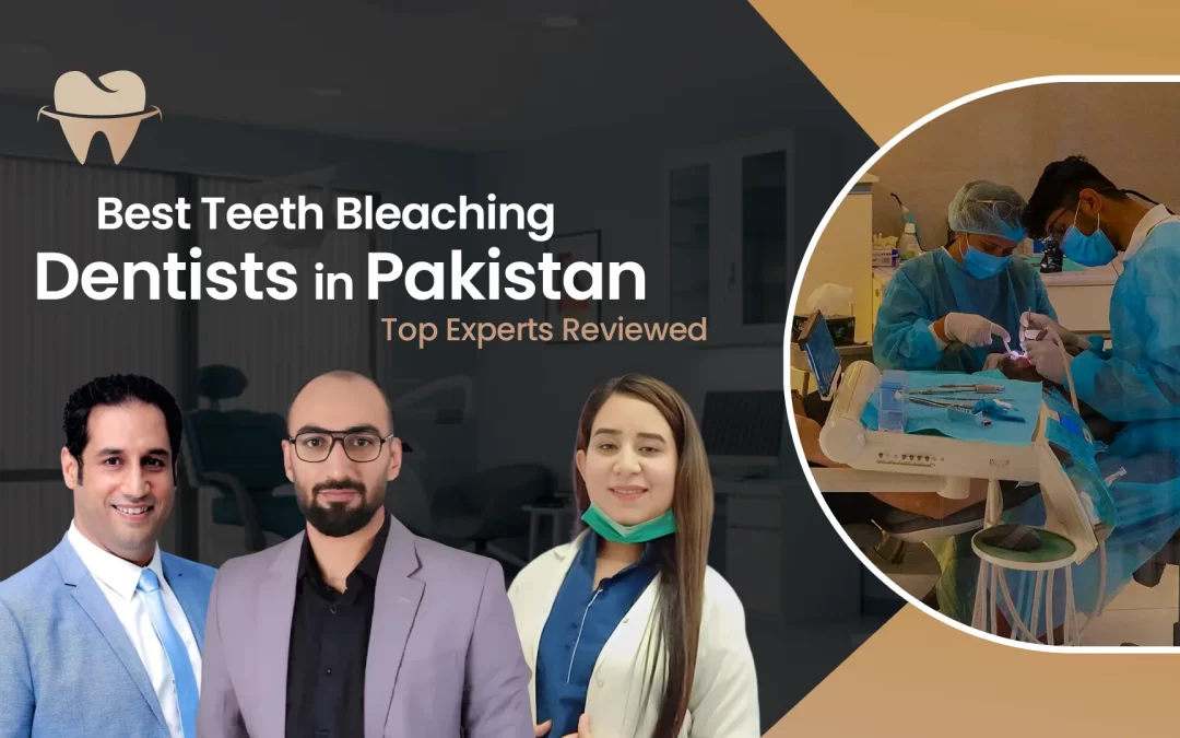 Best Teeth Bleaching Dentists in Pakistan – Top Experts Reviewed