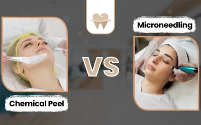Choosing Between Chemical Peel and Microneedling for Clearer Skin