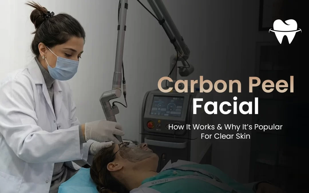 Carbon Peel Facial: How It Works and Why It’s Popular for Clear Skin