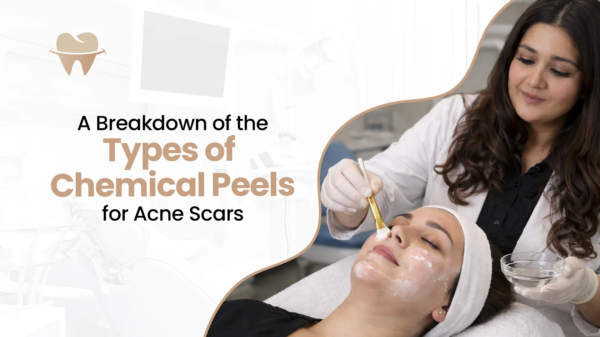 Types of Chemical Peels for Acne Scars Types of Chemical Peels for Acne Scars