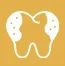 Cavities-or-Tooth-Decay