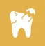 Chipped or Cracked Teeth