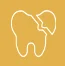 Cracked or Worn Teeth 