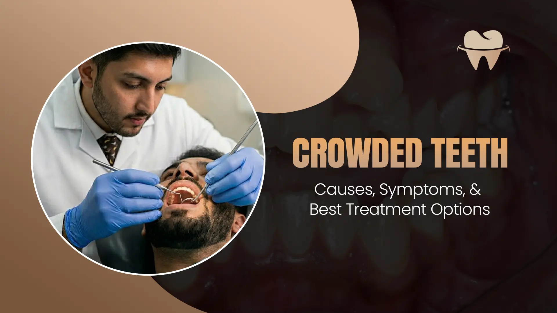 Crowded Teeth