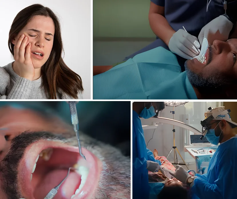 Exploring Wisdom Tooth Pain