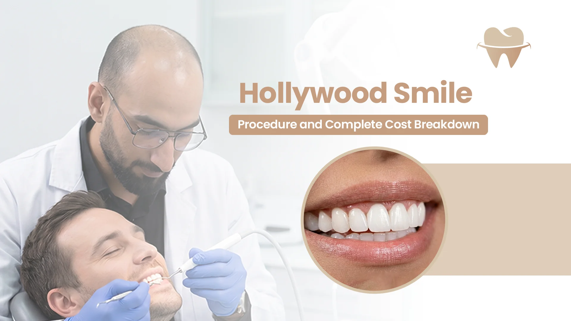 Hollywood Smile Teeth