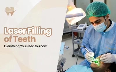 Laser Filling of Teeth: Everything You Need to Know in 2026