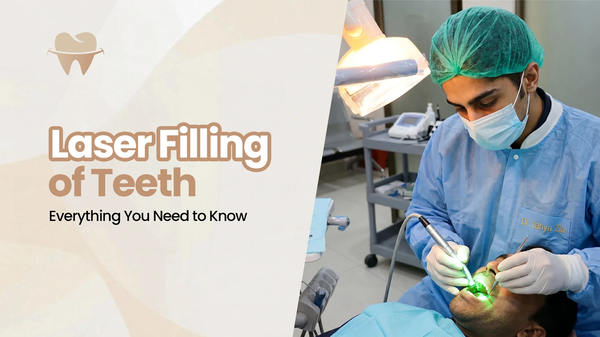 Laser Filling of Teeth