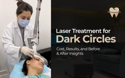 Laser Treatment for Dark Circles: Cost, Results, and Before & After Insights