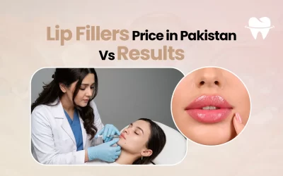 Lip Fillers Price in Pakistan vs Results: Is It Worth It?