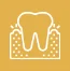 Swollen Gums
