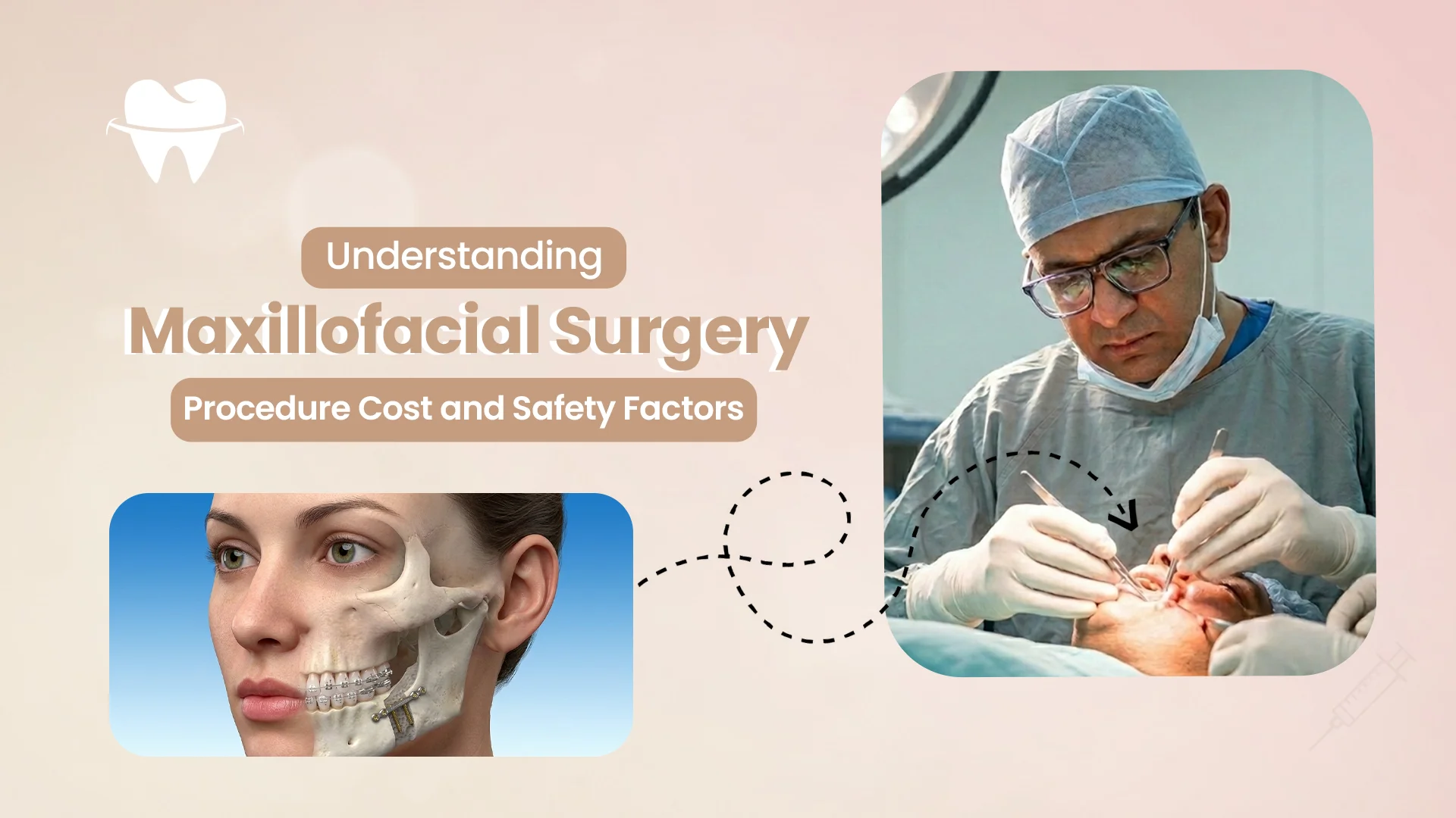 Maxillofacial Surgery