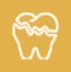 Chipped-or-Broken-Teeth
