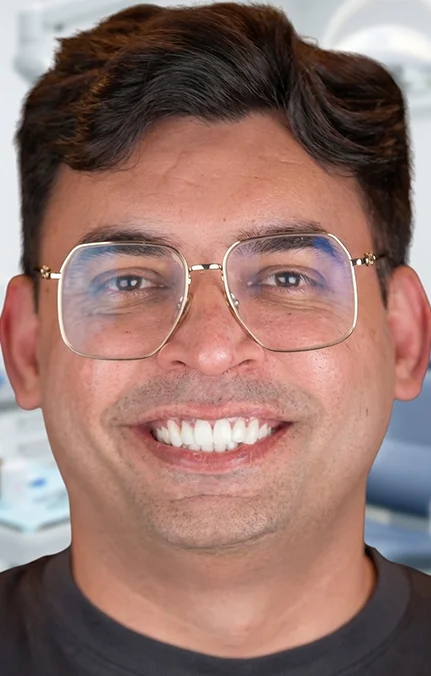 How Teeth Whitening Improves Your Smile and Confidence